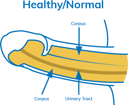 Diamgram: Healthy Penis